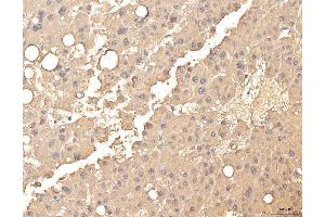 IHC analysis of BHMT using anti-BHMT antibody (ABIN7599940). (BHMT 抗体  (AA 13-386))