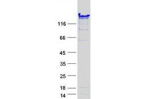 Western Blotting (WB) image for Nuclear Autoantigenic Sperm Protein (Histone-Binding) (NASP) (Transcript Variant 2) protein (Myc-DYKDDDDK Tag) (ABIN2726842)
