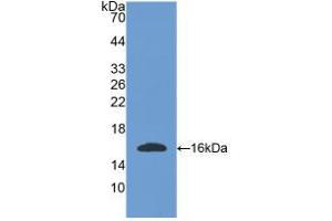 Western blot analysis of recombinant Mouse OGN. (OGN 抗体  (AA 180-298))