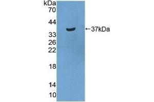 Detection of Recombinant STATH, Human using Polyclonal Antibody to Statherin (STATH) (STATH 抗体  (AA 1-62))