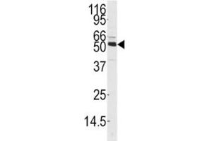 Western blot analysis of CAMKK1 antibody and mouse thymus tissue lysate. (CAMKK1 抗体  (AA 337-369))
