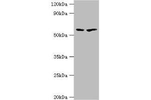 Western blot All lanes: 5-aminolevulinate synthase, erythroid-specific, mitochondrial antibody at 7 μg/mL Lane 1: 293T whole cell lysate Lane 2: Mouse brain tissue Secondary Goat polyclonal to rabbit IgG at 1/10000 dilution Predicted band size: 65, 61, 50, 64 kDa Observed band size: 65 kDa (ALAS2 抗体  (AA 50-320))