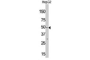 Western blot analysis of MLKLAK polyclonal antibody  in HepG2 cell line lysate (35 ug/lane). (ZAK 抗体  (Internal Region))