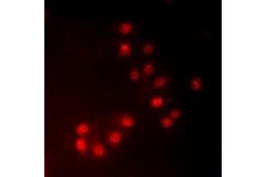 Immunofluorescent analysis of MKI67IP (pT234) staining in HeLa cells. (NIFK 抗体  (pSer234))