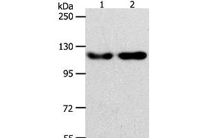 Western Blot analysis of Hela and Jurkat cell using ABL2 Polyclonal Antibody at dilution of 1:400 (ABL2 抗体)