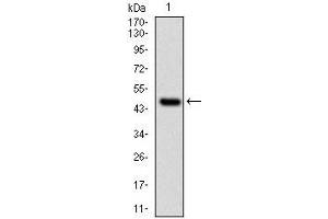 Western blot analysis using UBE2I mAb against human UBE2I (AA: 1-158) recombinant protein. (UBE2I 抗体)