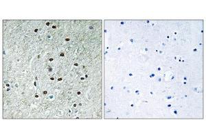 Immunohistochemistry analysis of paraffin-embedded human brain tissue using REXO1 antibody. (REXO1 抗体  (Internal Region))