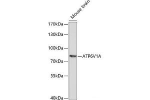 Western blot analysis of extracts of Mouse brain using ATP6V1A Polyclonal Antibody at dilution of 1:1000. (ATP6V1A 抗体)