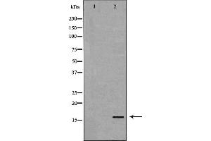 Western blot analysis of Blood  lysate using TTR antibody. (TTR 抗体  (C-Term))