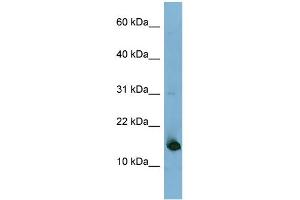 WB Suggested Anti-MED31 Antibody Titration: 0.