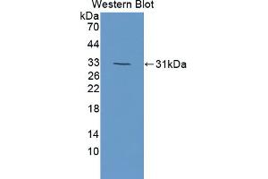 Western blot analysis of the recombinant protein. (DOK7 抗体  (AA 63-320))