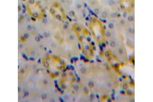 Used in DAB staining on fromalin fixed paraffin-embedded Kidney tissue (CLIC4 抗体  (AA 104-253))