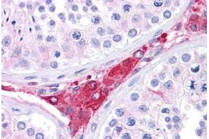 Human Testis: Formalin-Fixed, Paraffin-Embedded (FFPE) (BACE1 抗体  (AA 72-121))
