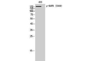 Western Blotting (WB) image for anti-Epidermal Growth Factor Receptor (EGFR) (pTyr869) antibody (ABIN3179433) (EGFR 抗体  (pTyr869))