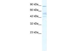CHRNB2 antibody used at 5 ug/ml to detect target protein. (CHRNB2 抗体)