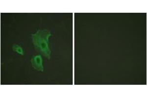 Immunofluorescence (IF) image for anti-B-Cell CLL/lymphoma 2 (BCL2) (AA 46-95), (pThr69) antibody (ABIN1531491)