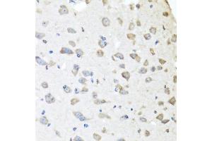 Immunohistochemistry of paraffin-embedded mouse brain using APCS antibody (ABIN5971040) at dilution of 1/100 (40x lens). (APCS 抗体)