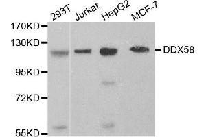 Western blot analysis of extracts of various cell lines, using DDX58 antibody. (DDX58 抗体)