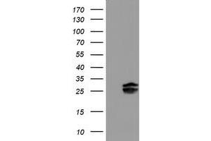 Western Blotting (WB) image for anti-Pallidin Homolog (PLDN) antibody (ABIN1500264) (Pallidin 抗体)