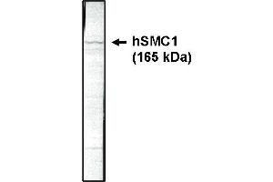 Western blotting using SMC1 antibody on HeLa cell lysate at 1 µg/ml. (SMC1A 抗体  (AA 402-894))