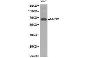 Western Blotting (WB) image for anti-Myocilin (MYOC) antibody (ABIN1873807) (MYOC 抗体)