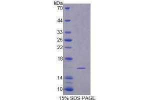 SDS-PAGE analysis of Human Semaphorin 3C Protein. (SEMA3C 蛋白)