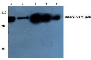 Western blot(WB) analysis of IKKα/β antibody at 1/500 dilution (IKK alpha 抗体)