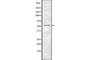 Western blot analysis of AGT using K562 whole  lysates. (AGT 抗体  (N-Term))