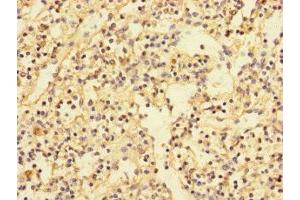 Immunohistochemistry of paraffin-embedded human spleen tissue using ABIN7169137 at dilution of 1:100 (PDIK1L 抗体  (AA 1-341))