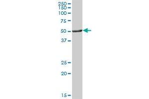 ALDH3A1 MaxPab polyclonal antibody. (ALDH3A1 抗体  (AA 1-453))