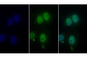 Detection of HDAC1 in Human Hela cell using Monoclonal Antibody to Histone Deacetylase 1 (HDAC1) (HDAC1 抗体  (AA 1-482))