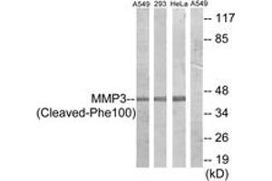 Western blot analysis of extracts from A549/293/HeLa cells, treated with etoposide 25uM 24h, using MMP3 (Cleaved-Phe100) Antibody. (MMP3 抗体  (Cleaved-Phe100))