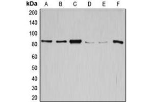 Western blot analysis of GYS1 expression in SW626 (A), SKOV3 (B), HeLa (C), K562 (D), HepG2 (E), mouse liver (F) whole cell lysates. (Glycogen Synthase 1 抗体  (C-Term))