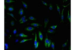 Immunofluorescence (IF) image for anti-ATPase, Ca++ Transporting, Cardiac Muscle, Slow Twitch 2 (ATP2A2) (AA 314-756) antibody (ABIN7168600)