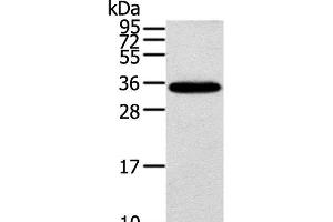 Western Blot analysis of Mouse brain tissue using KCNMB3 Polyclonal Antibody at dilution of 1:300 (KCNMB3 抗体)