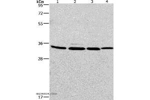 Western blot analysis of A549, 231, PC3 and hela cell, using MAD2L1BP Polyclonal Antibody at dilution of 1:675 (MAD2L1BP 抗体)