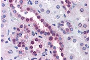 Human Kidney: Formalin-Fixed, Paraffin-Embedded (FFPE) (STK33 抗体  (AA 1-515))