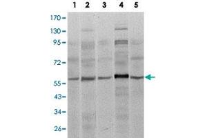 Western blot analysis of SMAD4 monoclonal antobody, clone 4G1C6  against A-431 (1), SK-N-SH (2), K-562 (3), HepG2 (4) and HUVE12 (5) cell lysate. (SMAD4 抗体)