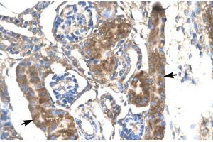Human kidney; SLC17A2 antibody - middle region in Human kidney cells using Immunohistochemistry (SLC17A2 抗体  (Middle Region))
