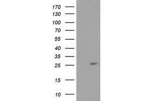 Western Blotting (WB) image for anti-Cyclin-Dependent Kinase Inhibitor 3 (CDKN3) antibody (ABIN1497457) (CDKN3 抗体)