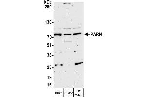 Western Blotting (WB) image for anti-Poly A Specific Ribonuclease (PARN) (AA 589-639) antibody (ABIN7454930)