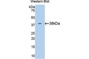 Western blot analysis of the recombinant protein. (KRT15 抗体  (AA 105-411))