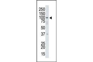 Image no. 1 for anti-Ubiquitin Specific Peptidase 13 (Isopeptidase T-3) (USP13) (Middle Region) antibody (ABIN357545) (USP13 抗体  (Middle Region))