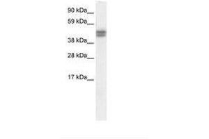 Image no. 1 for anti-SAP30 Binding Protein (SAP30BP) (AA 35-84) antibody (ABIN6736065)