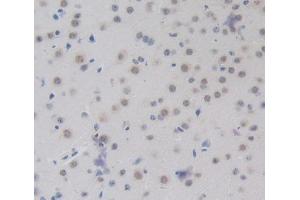 Used in DAB staining on fromalin fixed paraffin- embedded brain tissue (CEBPD 抗体  (AA 51-251))