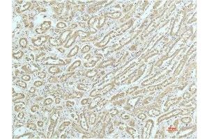 Immunohistochemical analysis of paraffin-embedded Human Kidney Tissue using a-actinin Mouse mAb diluted at 1:200. (ACTN1 抗体)