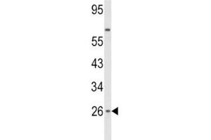 Western blot analysis of IFNB1 antibody and HepG2 lysate. (IFNB1 抗体  (AA 39-66))