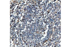 IHC analysis of VCAM1 using anti-VCAM1 antibody (ABIN5692810). (VCAM1 抗体  (AA 25-270))