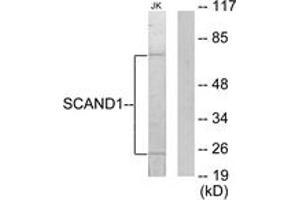 Western Blotting (WB) image for anti-SCAN Domain Containing 1 (SCAND1) (AA 61-110) antibody (ABIN2889527) (SCAND1 抗体  (AA 61-110))