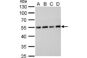 Western Blotting (WB) image for anti-Tubulin, alpha 1B (TUBA1B) antibody (ABIN2855283)